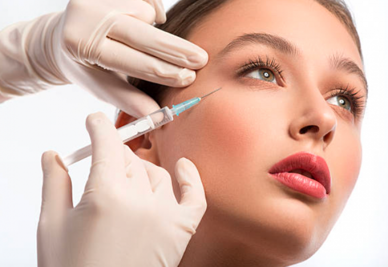 Aplicações de Botox Vila Olímpia - Toxina Botulínica na Testa