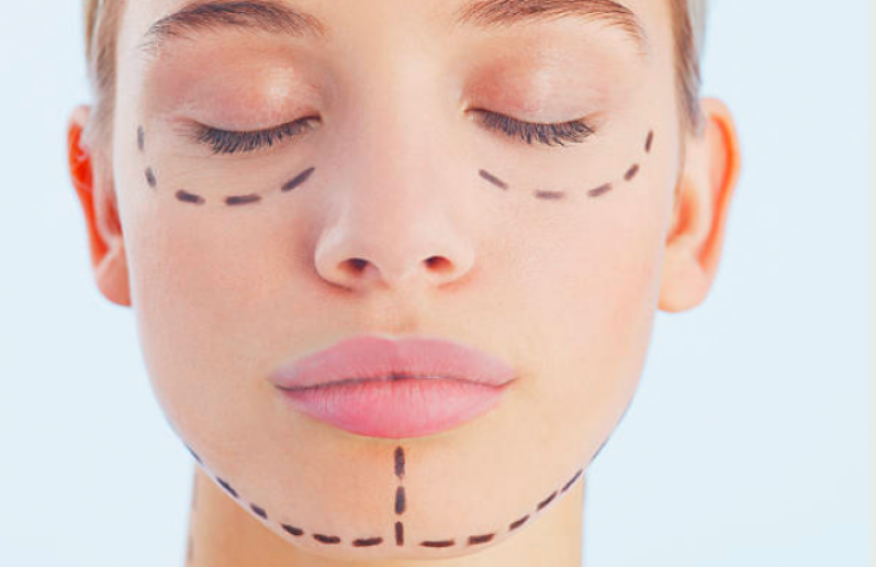 Cotação de Harmonização Facial no Queixo Bom Retiro - Harmonização Facial Mulher