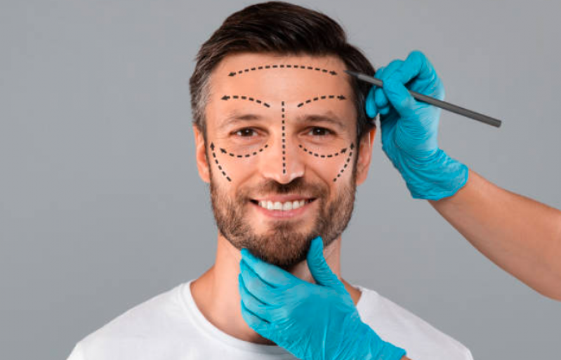 Cotação de Procedimento Harmonização Facial Vila Olímpia - Harmonização Facial em Homens