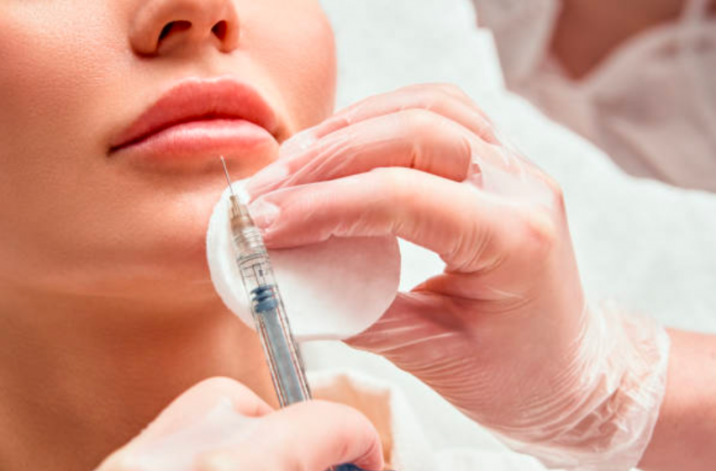 Preenchimento Facial com ácido Hialurônico Vila Maria - Botox e Preenchimento Facial
