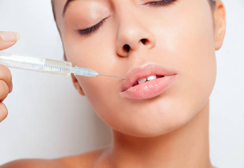 Procedimento de Preenchimento Facial ácido Hialurônico São Caetano do Sul - Botox e Preenchimento Facial