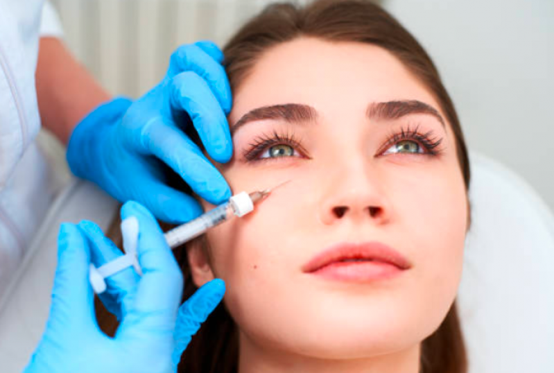 Procedimento de Preenchimento Facial com ácido Hialurônico Belém - Preenchimento Facial Olheiras