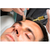 agendar tratamento para acne e manchas Vila Medeiros