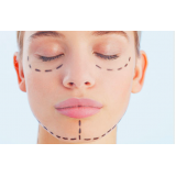 clínica de harmonização facial feminina Freguesia do Ó