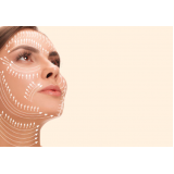 cotação de harmonização facial com ácido hialurônico Santa Cecília