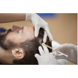 intradermoterapia facial marcar Salesópolis