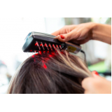 tratamento capilar para queda de cabelo preços Cidade Tiradentes