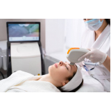tratamento de ultraformer facial Vila Prudente