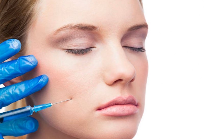 Valor de Preenchimento no Rosto Ponte Rasa - Botox e Preenchimento Facial